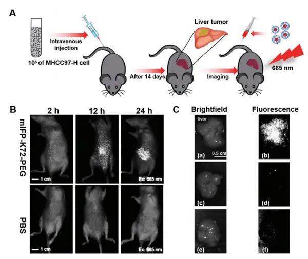 b)注射mifp-k72-peg后,肝脏中有转移性肿瘤结节的小鼠体内nir荧光成像