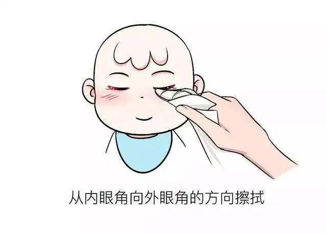 新生儿眼部护理图片