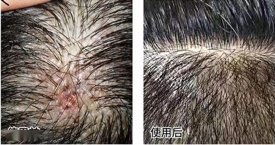 搞定这件事,5天不洗头也不油,秒变"小脸女神"!_头发