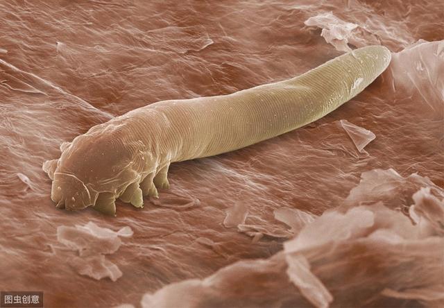 ③ 一期若虫及二期若虫,虫体最长,长于幼虫及成虫期,条件适宜可见其