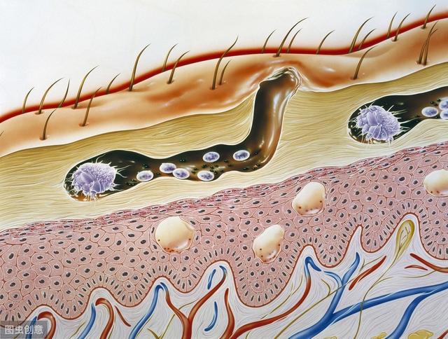 什麼是蠕形蟎顯微鏡下蟎蟲是怎麼樣的眼癢眼乾或許與它有關