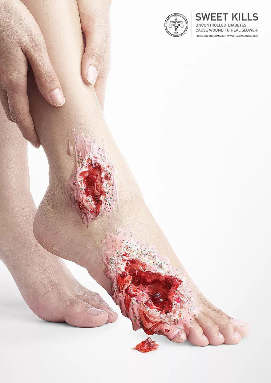 你会发现这些"伤口"都是用巧克力酱,奶油,糖霜等伪装出来的.