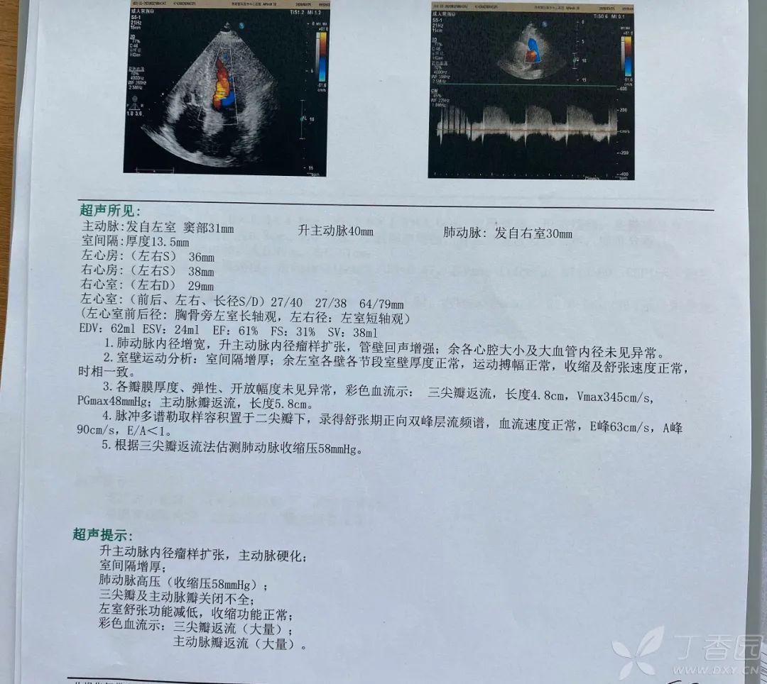 矽肺的腎綜病人無法耐受腎活檢,何去何從?