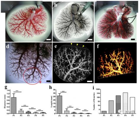 南科大成功构建透明化肝脏离体模型,以评估肿瘤血管栓塞治疗