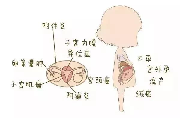 生育期的女性有性生活甚至人流经历,很多病菌便可由阴道进入子宫,引发