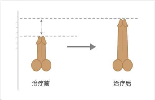 正常的阴痉图片