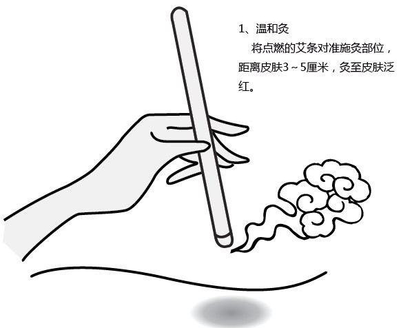 金艾灸艾火循经所表现出的三种形态你知道多少