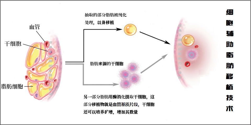 脂肪肝细胞诱导剂：破解肝脏健康难题的一把钥匙