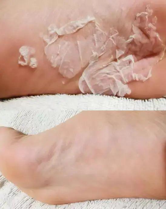 林允居然公开撕脚皮丢掉偶像包袱的她又教了一招护足技巧原来这里才是