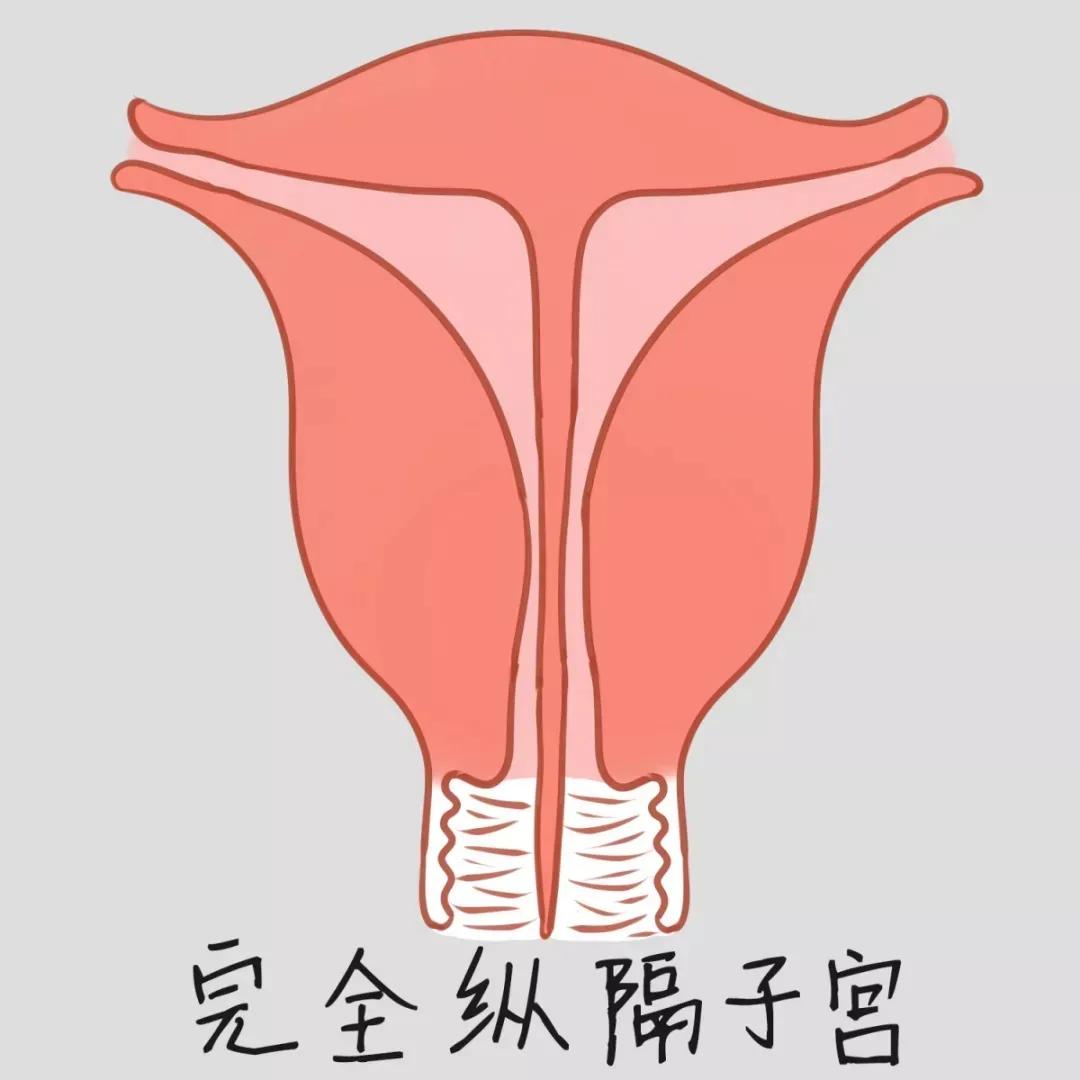 孕八周子宫位置示意图图片