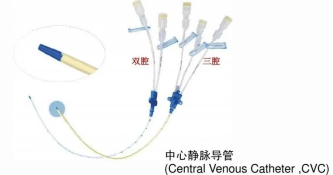 输液港结构图片