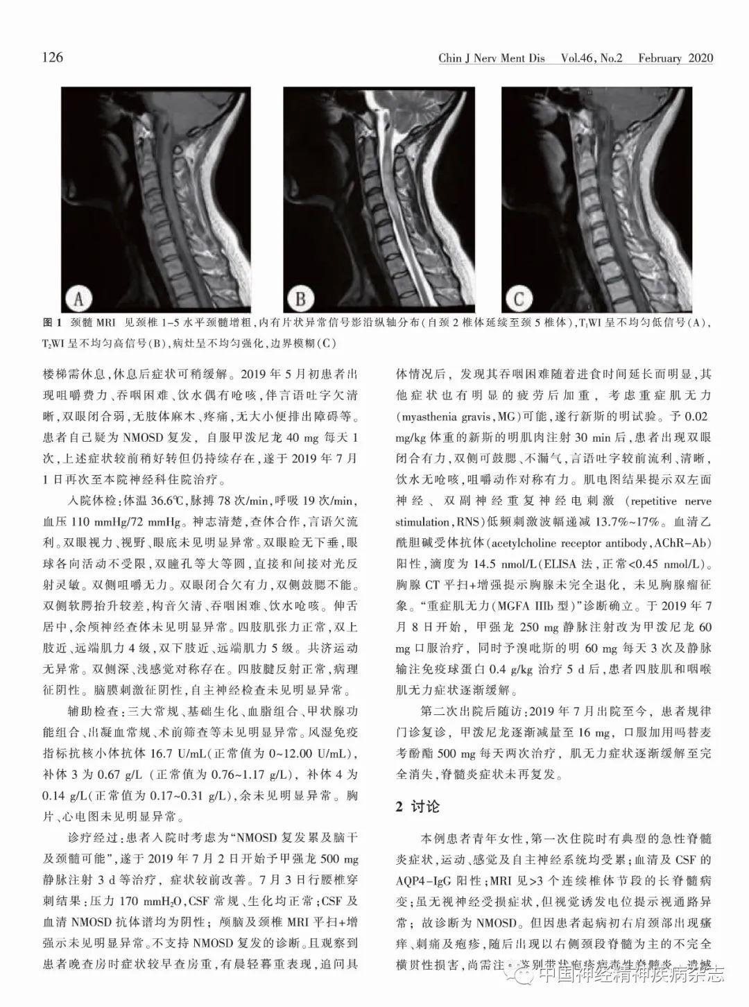 四肢肌無力併吞咽困難——視神經脊髓炎譜系疾病伴發重症肌無力陳嘉欣