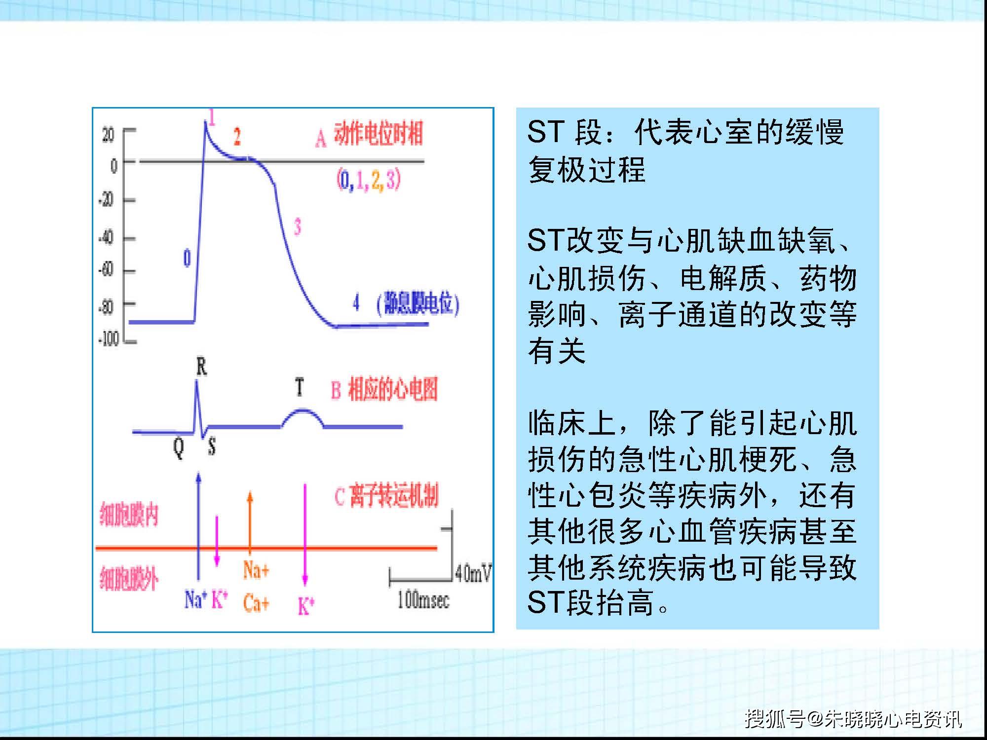 心电图st段的生理意义图片