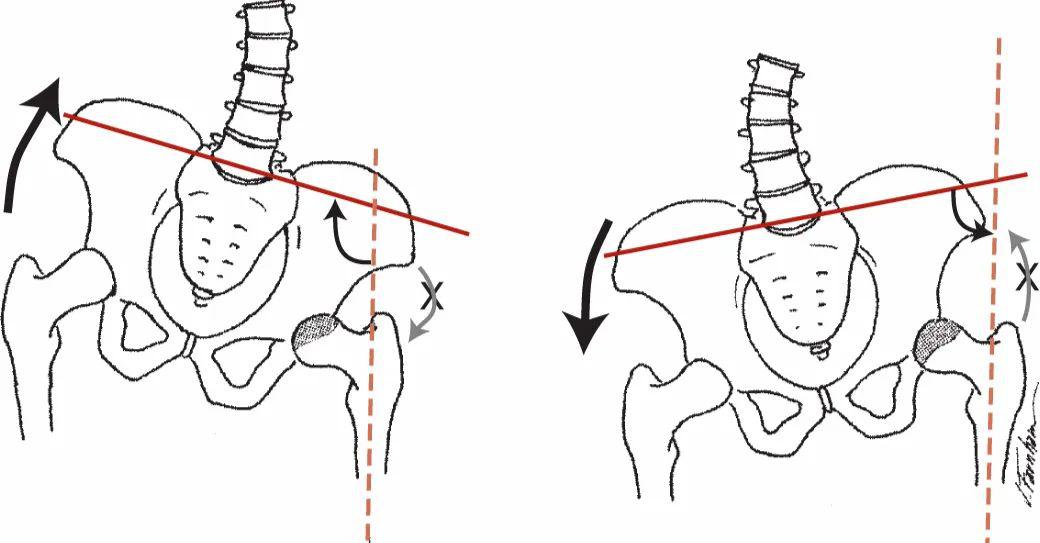 你知道骨盆傾斜嗎