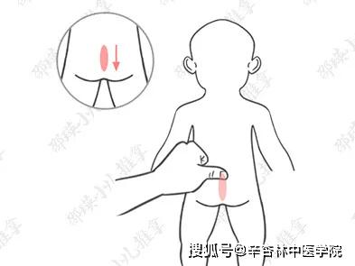 针扎手指挤出黄色液体孩子积食竟好了真的有效吗