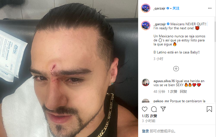 原创wwe摔小辉新闻砍刀脚威力如何安吉尔加扎直接被踢伤