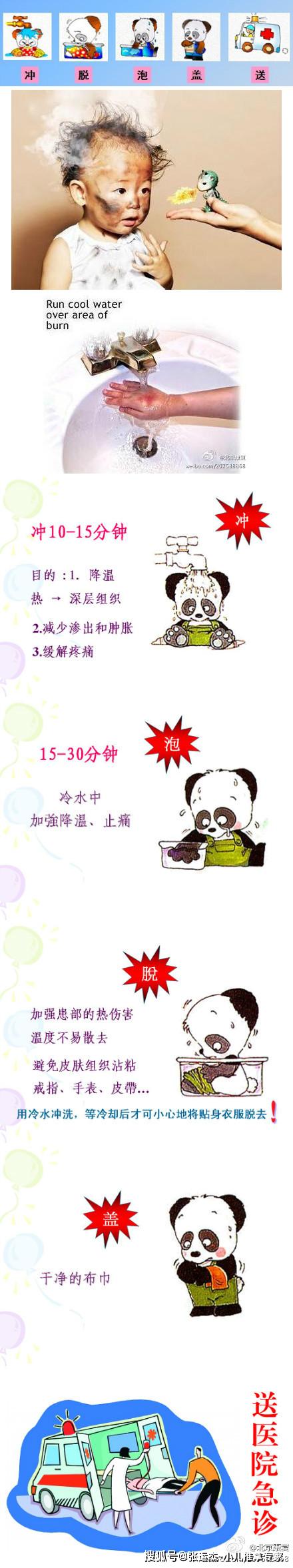 孩子|张运杰~小儿推拿专家：孩子被烫伤后，应该如何快速处理呢？