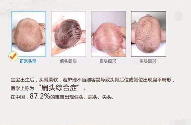 原创宝宝头型睡扁不要慌补救扁头有三招正确睡姿父母要了解