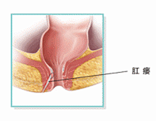 答案虽是肯定的却也不太一样_肛门