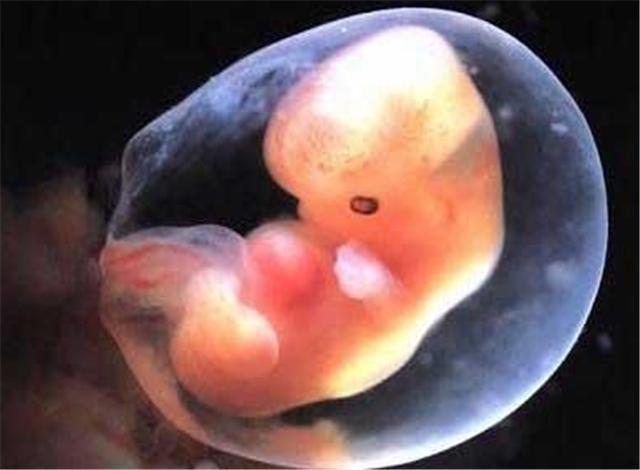 怀孕5个月的胎儿是什么样子的呢?孕妇怎样保养好身体呢?
