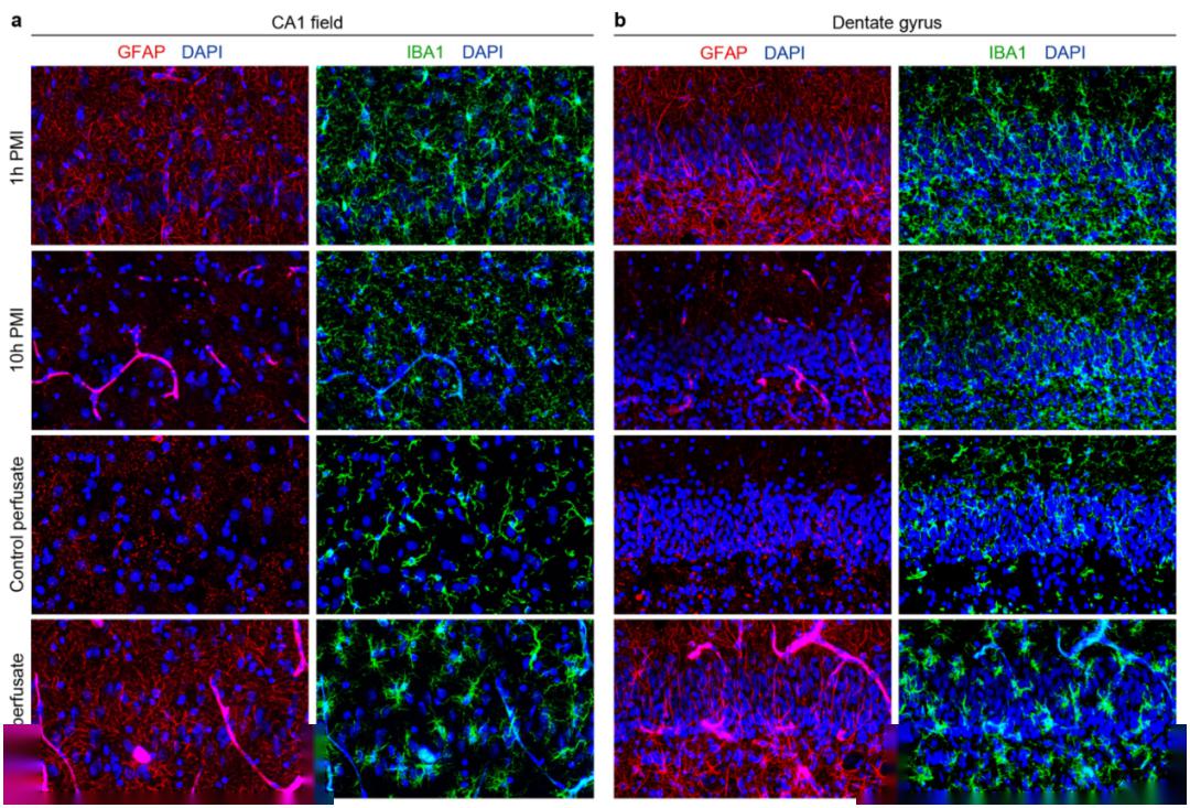神经元光镜结构图红蓝图片
