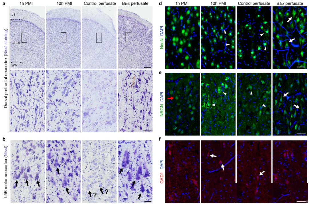 a,前额叶皮层中actcasp3(绿色)的免疫荧光染色的共聚焦最大强度投影.