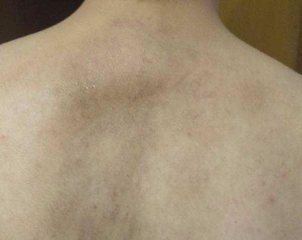 清洁的话,很容易造成肌肤表面污垢堆积,角质层增厚,皮肤变得暗沉粗糙