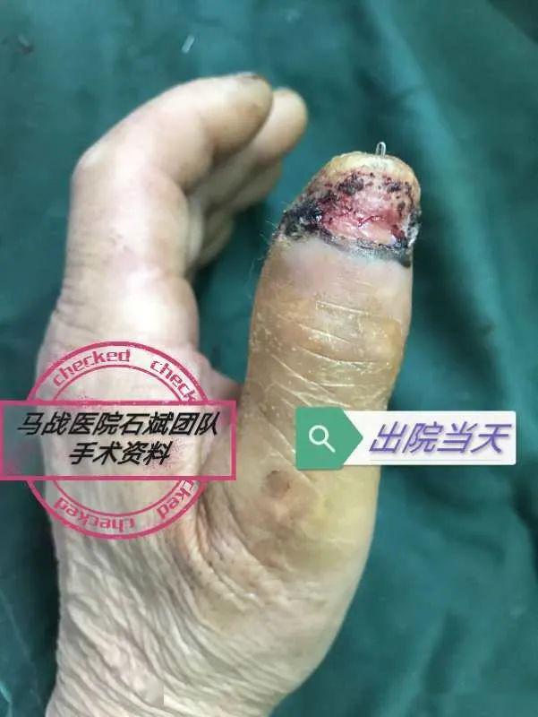 再造,各种创面修复,神经血管肌腱修复,手足功能重建,畸形矫正,创伤