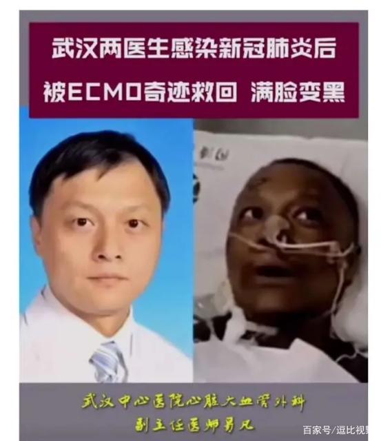 李文亮同事被抢救回来变"黑人",让人心疼