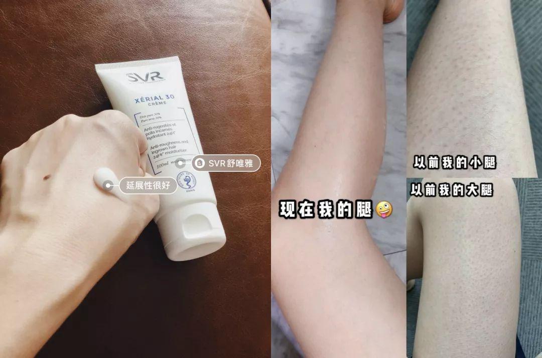 哪个明星的皮肤是鸡皮疙瘩的简单介绍