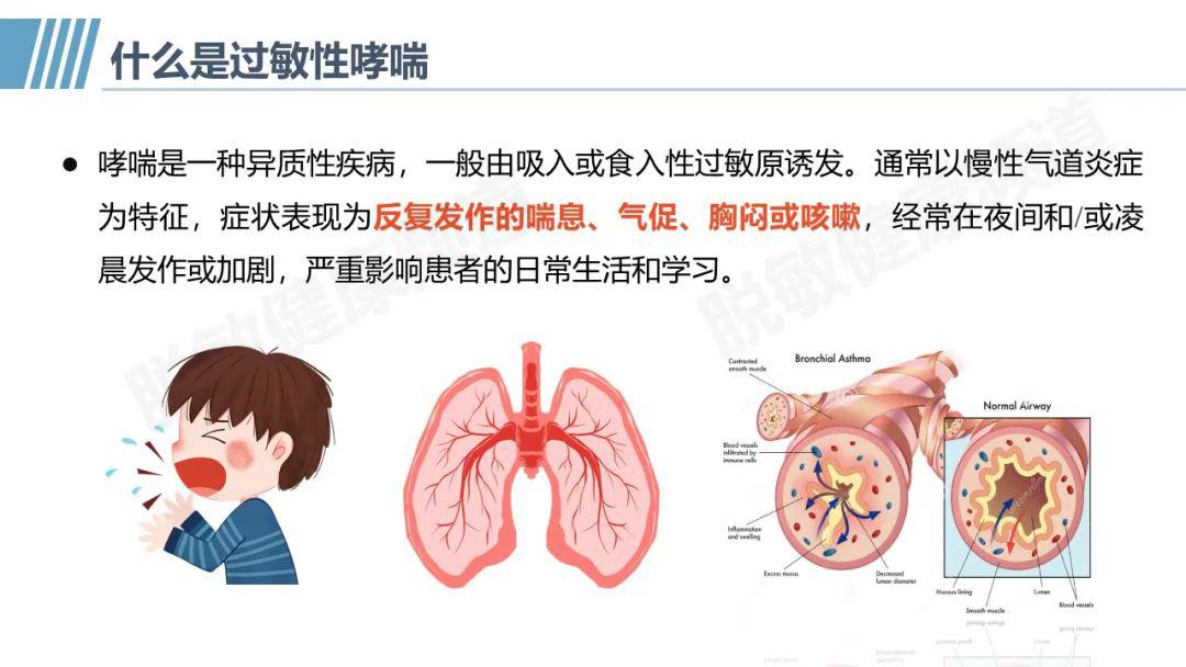 过敏性哮喘作为长期慢性的炎症性疾病,临床上应采用who推荐的四位