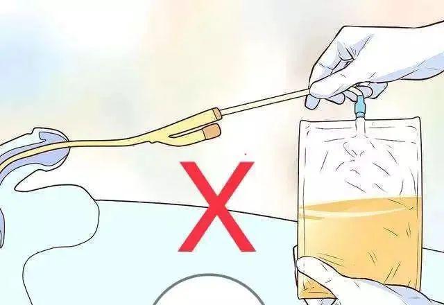 别看一根小小的导尿管,在家护理可不简单