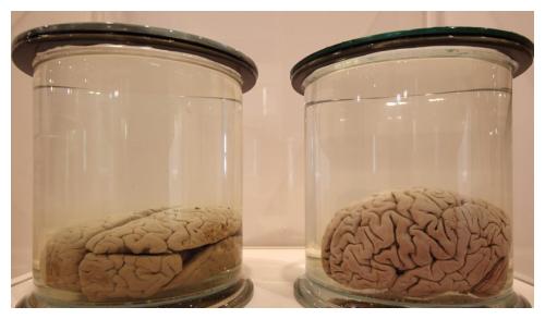 "缸中之脑"在猪身上初步实现,科学家开始怀疑人类存在的真实性_大脑