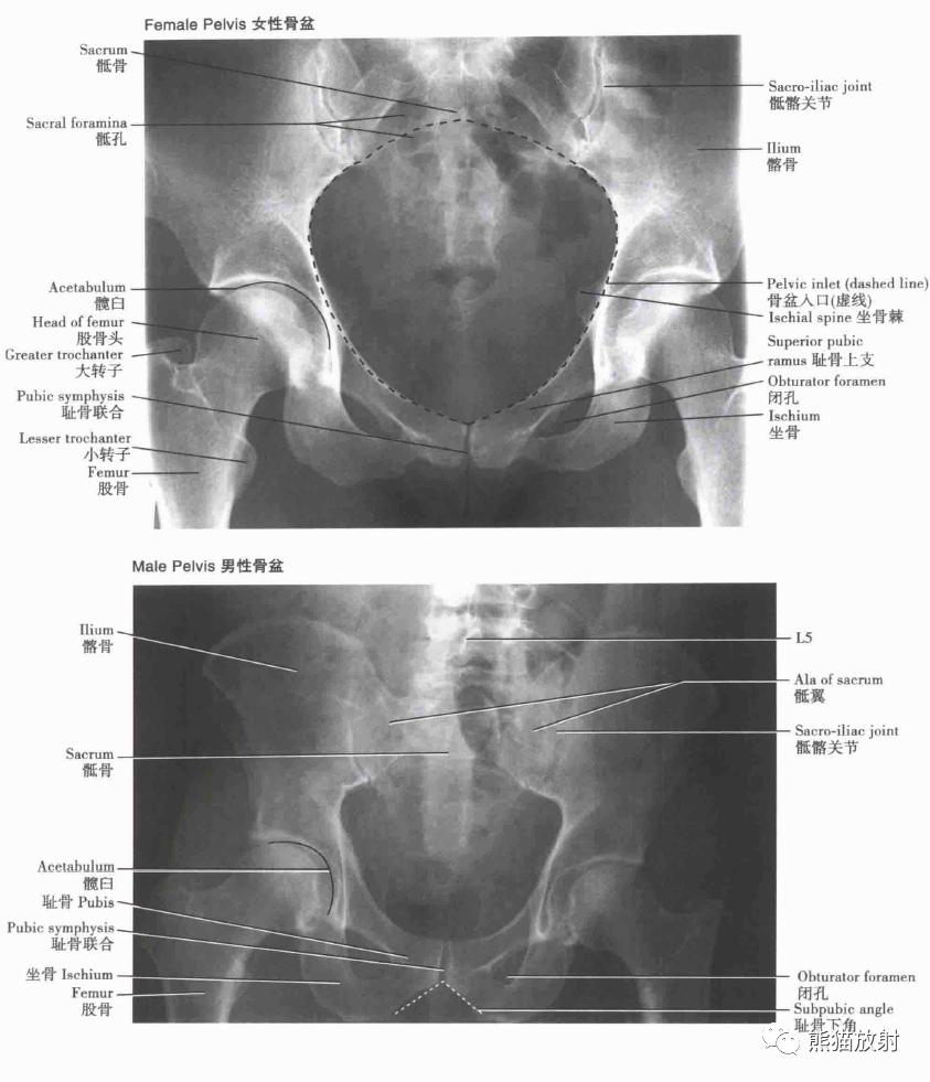 骨盆x光片各部位图解图片