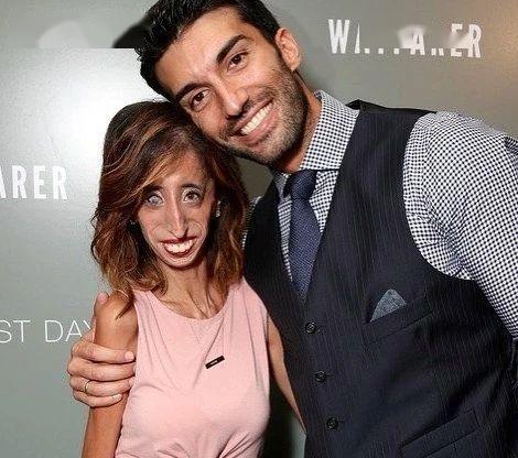 全网攻击的世界最丑女人竟鼓舞千万人我的存在就是上帝的美意