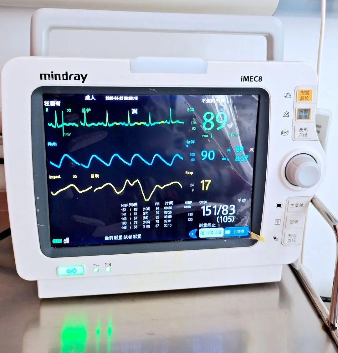 为什么要监测生命体征?