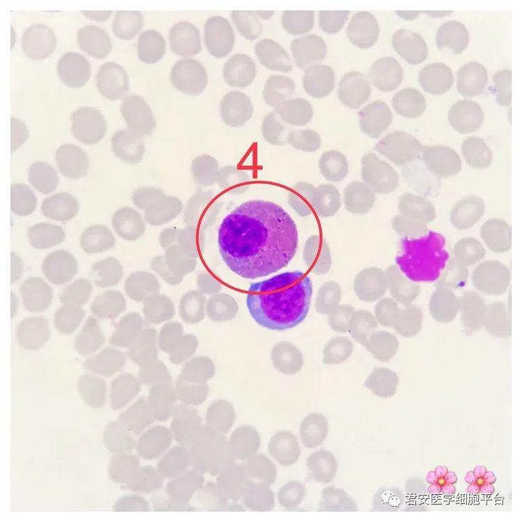 椭圆形红细胞图片