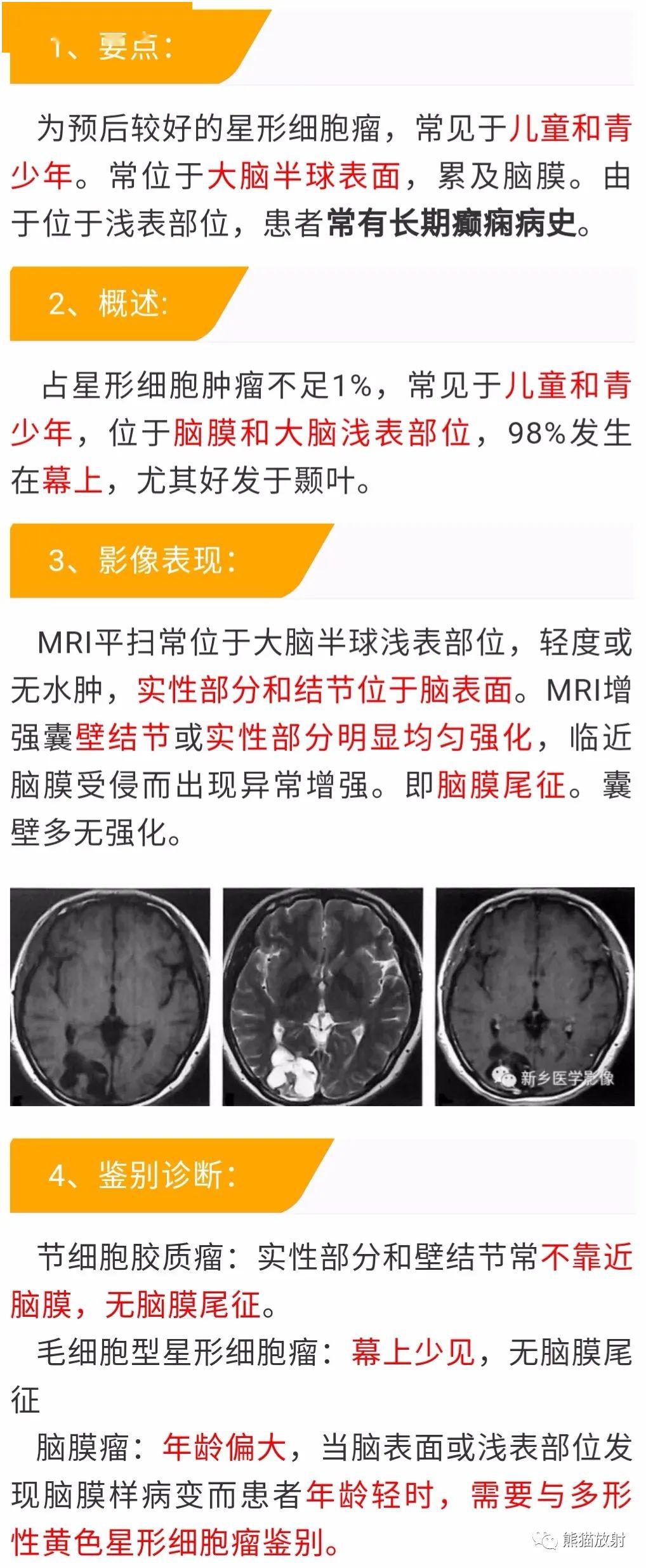 幕上囊實性佔位之丨小打卡讀片精選38