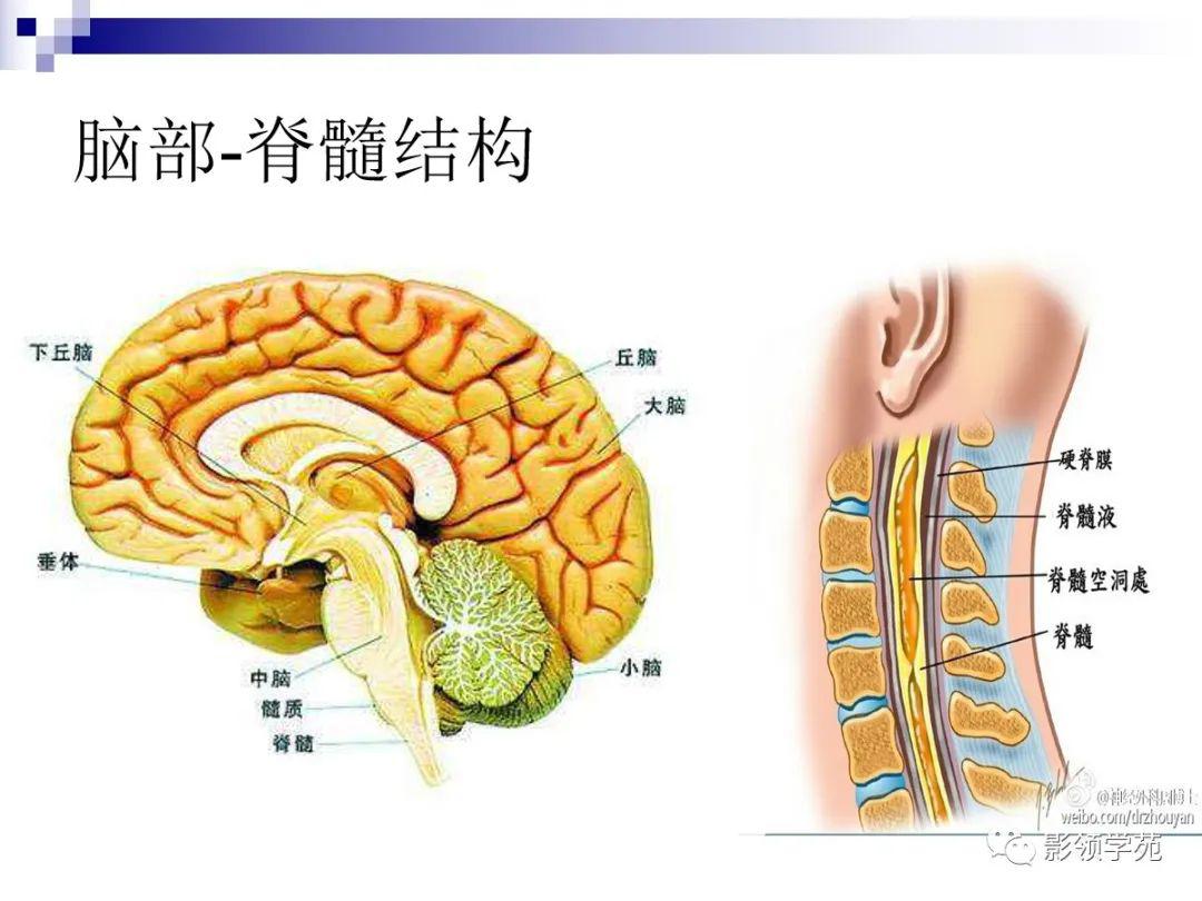 小脑扁桃体解剖图图片