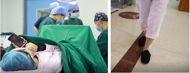 问题|马桂文：拇外翻哪家医院好？真人经历分享