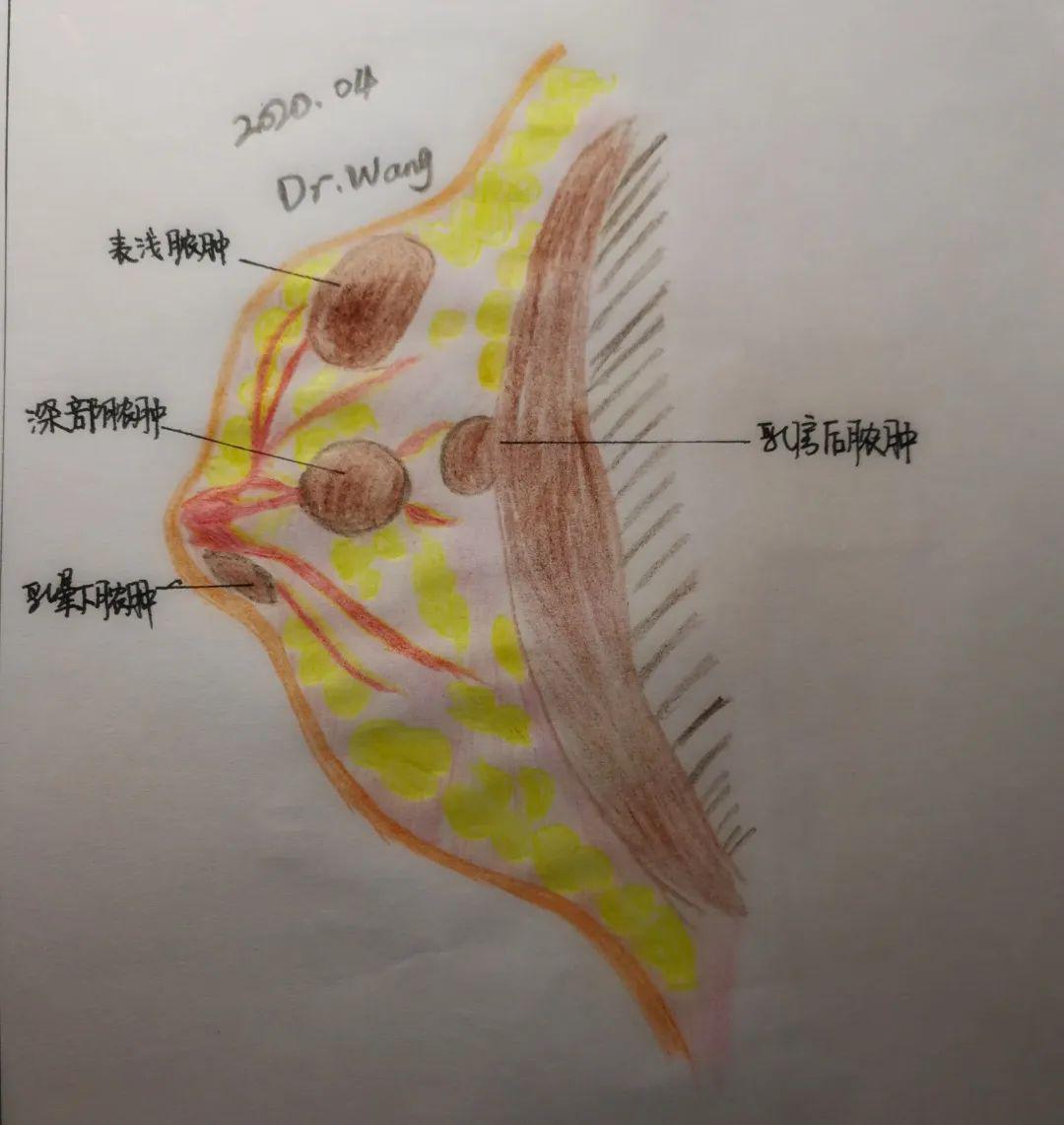 专科科普无痛换药治疗乳房脓肿省二中医院这个重点专科怎么这么牛