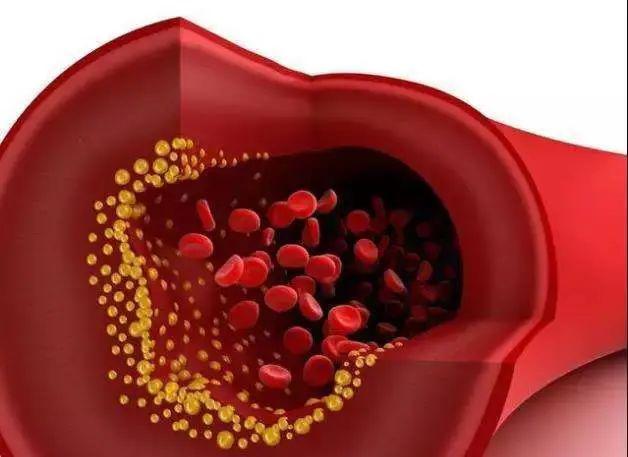 36岁男子的血液标本静置后有一层牛奶最终诱发胰腺炎