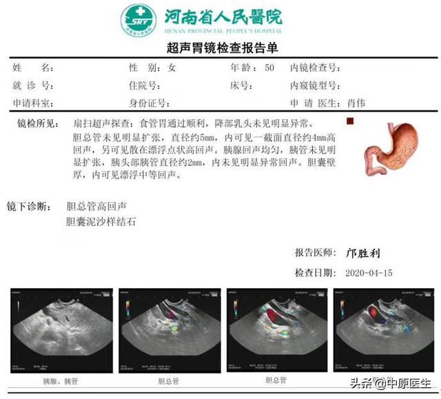 当地医院治好了她的急性胰腺炎却说不清病因她又来省级医院就诊