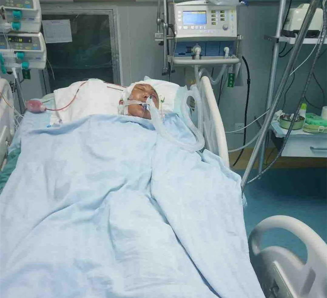 丈夫意外车祸重伤至今仍在重症监护室生死未卜我何时能看到希望