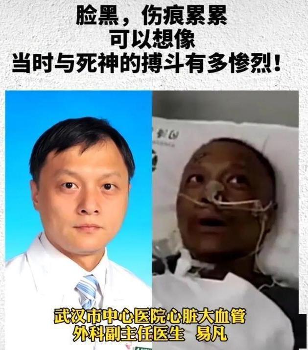 前两天武汉传来消息,两位武汉中心医院感染新冠病毒的医生,成功的脱下