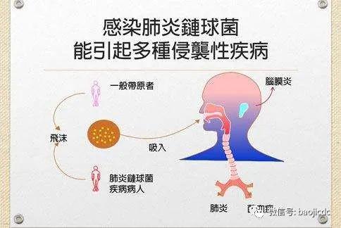 肺炎鏈球菌病的預防