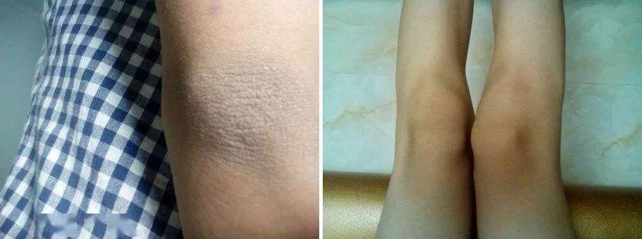 冰淇淋质地的磨砂膏!用它,无痛去角质,全身嫩滑如换皮!