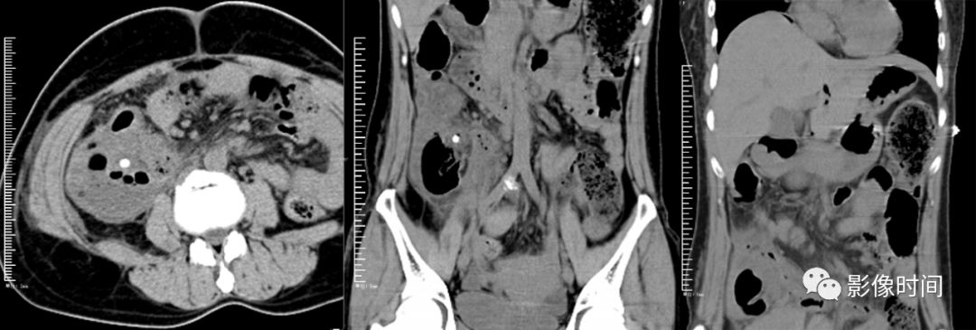 这组图片你一定需要_粪石
