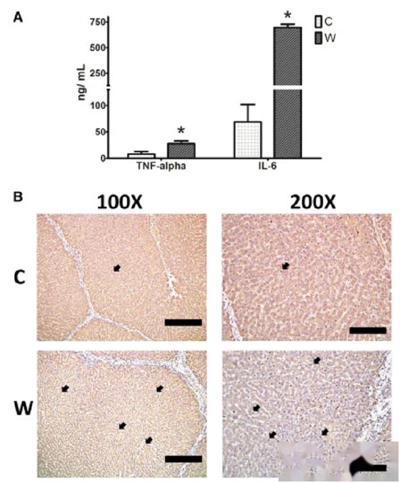 蛋白芯片jnutrbiochem文章解析抗体芯片在非酒精脂肪肝