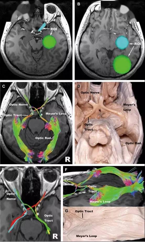 一嗅二视三动眼,四滑五叉六外展